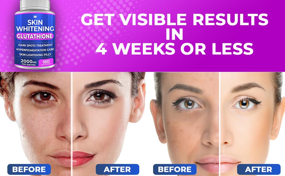 قبل و بعد از استفاده از قرص سفید کننده پوست خارجی مدل Skin Whitening